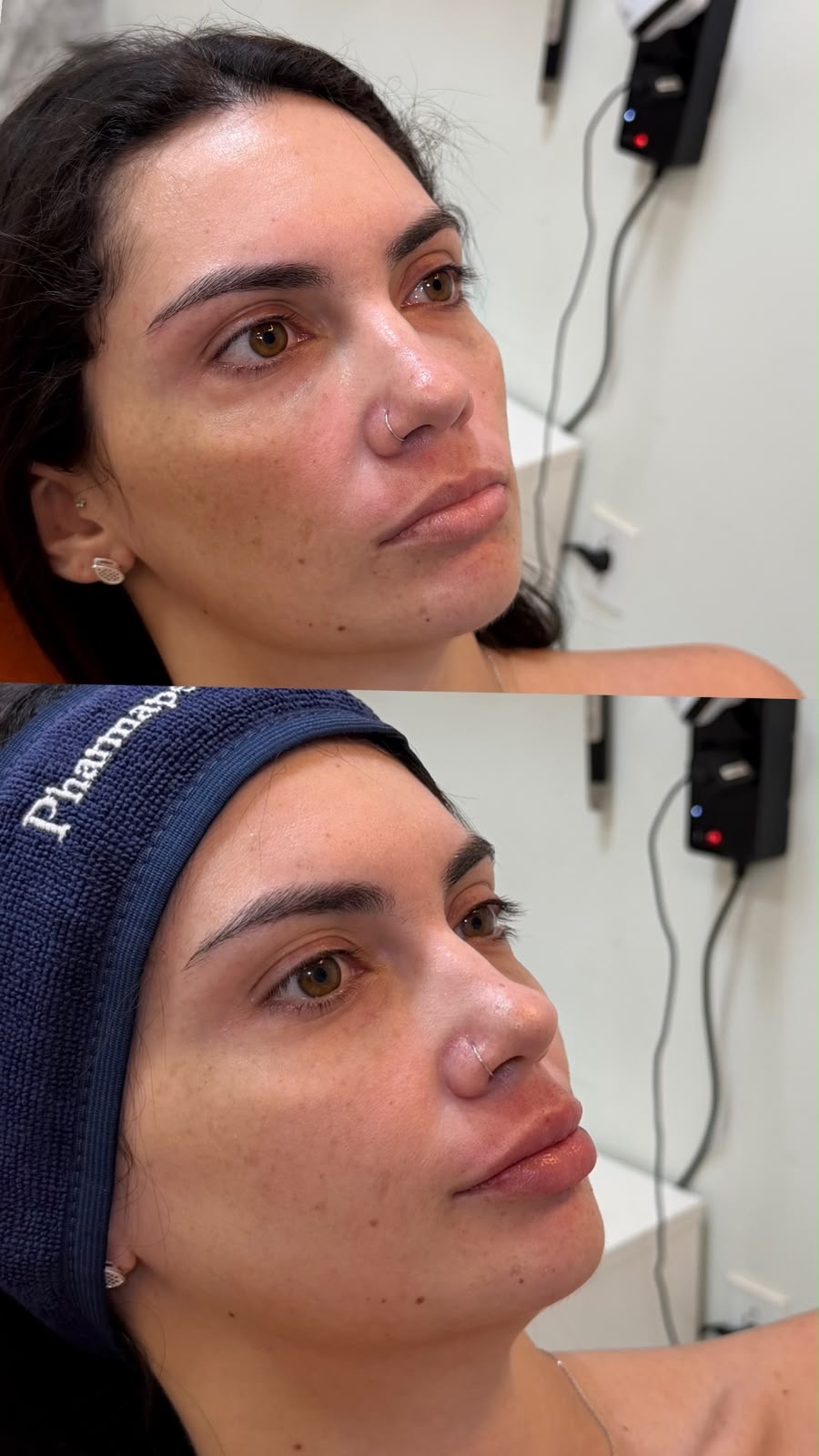 Detalhe de um sorriso natural e do contorno facial, imagem ilustrativa